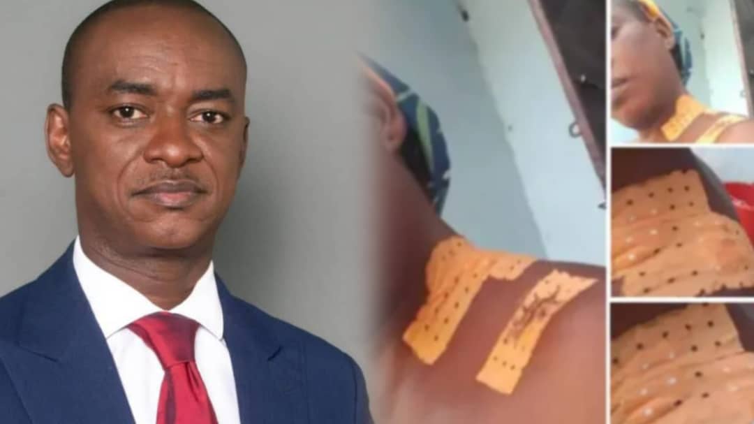 Cameroun : L'indignation de Cabral Libii face à l'agression d'une enseignante à Taibong